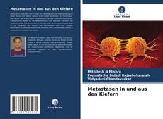 Bookcover of Metastasen in und aus den Kiefern