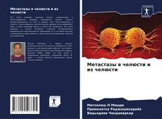 Buchcover von Метастазы в челюсти и из челюсти
