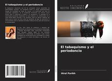 Couverture de El tabaquismo y el periodoncio