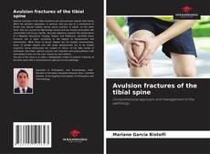 Couverture de Avulsion fractures of the tibial spine