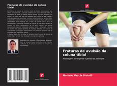 Capa do livro de Fraturas de avulsão da coluna tibial 