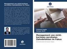 Bookcover of Management von nicht-kariösen zervikalen Zahndefekten im Fokus