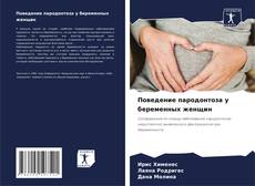 Buchcover von Поведение пародонтоза у беременных женщин