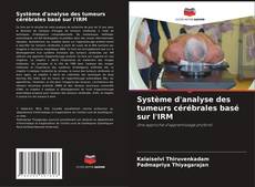 Buchcover von Système d'analyse des tumeurs cérébrales basé sur l'IRM