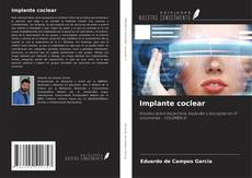 Capa do livro de Implante coclear 