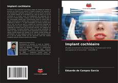 Bookcover of Implant cochléaire