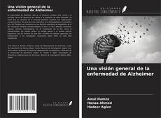Buchcover von Una visión general de la enfermedad de Alzheimer