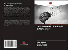 Buchcover von Un aperçu de la maladie d'Alzheimer