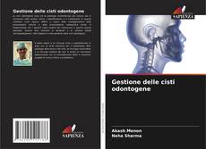 Bookcover of Gestione delle cisti odontogene