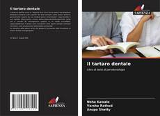 Обложка Il tartaro dentale