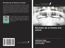 Bookcover of Revisión de la fístula oro-antral