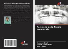 Buchcover von Revisione della fistola oro-antrale
