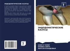 Bookcover of ЭНДОДОНКТИЧЕСКИЕ КАЗУСЫ