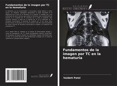 Fundamentos de la imagen por TC en la hematuria kitap kapağı