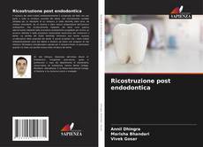Bookcover of Ricostruzione post endodontica