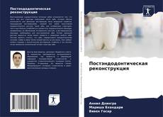 Bookcover of Постэндодонтическая реконструкция