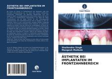 Copertina di ÄSTHETIK BEI IMPLANTATEN IM FRONTZAHNBEREICH