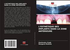 Buchcover von L'ESTHÉTIQUE DES IMPLANTS DANS LA ZONE ANTÉRIEURE