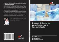 Couverture de Disegni di lembi in parodontologia e implantologia