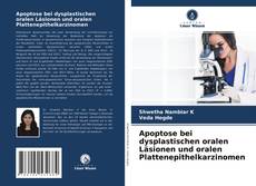 Buchcover von Apoptose bei dysplastischen oralen Läsionen und oralen Plattenepithelkarzinomen