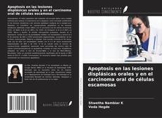 Bookcover of Apoptosis en las lesiones displásicas orales y en el carcinoma oral de células escamosas
