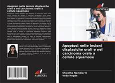 Buchcover von Apoptosi nelle lesioni displasiche orali e nel carcinoma orale a cellule squamose