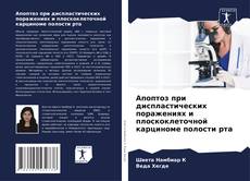 Апоптоз при диспластических поражениях и плоскоклеточной карциноме полости рта的封面