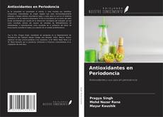 Bookcover of Antioxidantes en Periodoncia