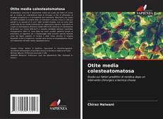 Bookcover of Otite media colesteatomatosa
