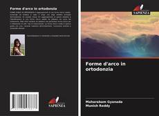 Bookcover of Forme d'arco in ortodonzia