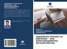 Capa do livro de Impaktierter Eckzahn im Oberkiefer - eine kieferorthopädische Herausforderung 