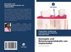 Konzepte und Belastungsprotokolle von Implantaten kitap kapağı