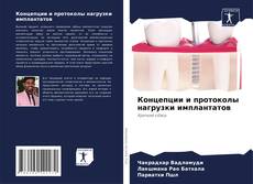 Bookcover of Концепции и протоколы нагрузки имплантатов