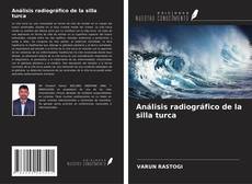 Bookcover of Análisis radiográfico de la silla turca
