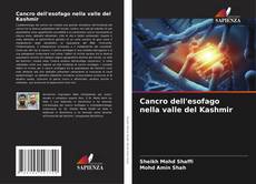 Buchcover von Cancro dell'esofago nella valle del Kashmir