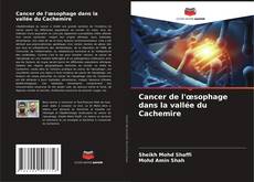 Buchcover von Cancer de l'œsophage dans la vallée du Cachemire