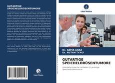 Bookcover of GUTARTIGE SPEICHELDRÜSENTUMORE