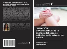 Bookcover of "MEDICIÓN CUANTITATIVA" de la anchura del espacio articular en la artrosis de rodilla