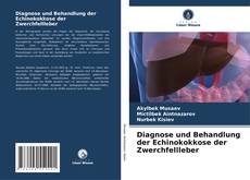Buchcover von Diagnose und Behandlung der Echinokokkose der Zwerchfellleber