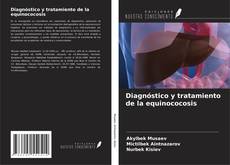Bookcover of Diagnóstico y tratamiento de la equinococosis