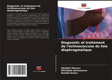 Capa do livro de Diagnostic et traitement de l'échinococcose du foie diaphragmatique 