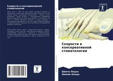 Buchcover von Скорости в консервативной стоматологии