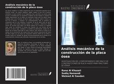 Bookcover of Análisis mecánico de la construcción de la placa ósea