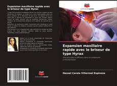 Buchcover von Expansion maxillaire rapide avec le briseur de type Hyrax
