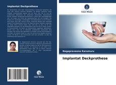 Buchcover von Implantat Deckprothese
