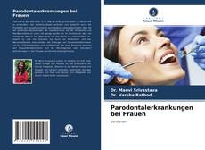 Buchcover von Parodontalerkrankungen bei Frauen