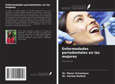 Enfermedades periodontales en las mujeres kitap kapağı