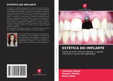 Bookcover of ESTÉTICA DO IMPLANTE