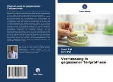 Bookcover of Vermessung in gegossener Teilprothese