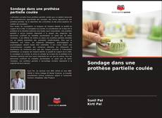 Bookcover of Sondage dans une prothèse partielle coulée